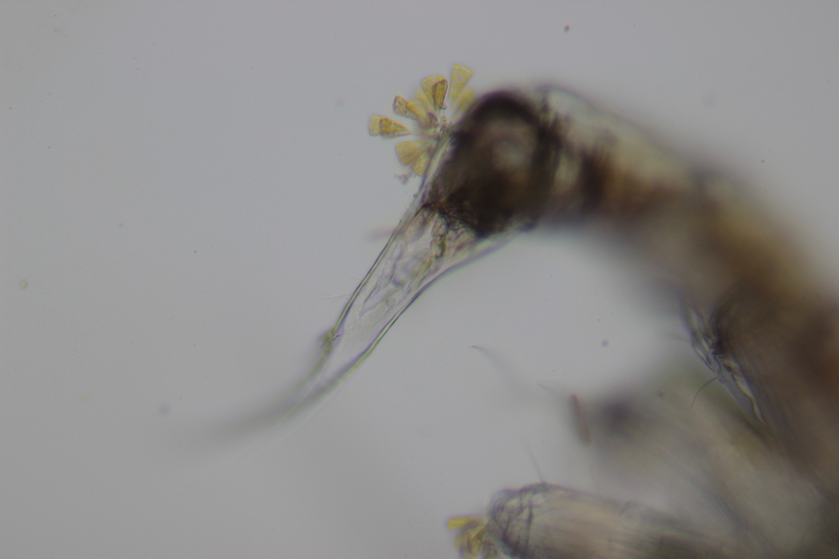 28:04:2021_plankton Oostende_zoealarve krab_telson met diatomeeën